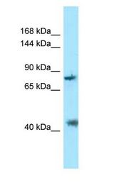 PACS1 Antibody - PACS1 antibody Western Blot of Placenta.  This image was taken for the unconjugated form of this product. Other forms have not been tested.