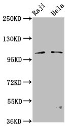 PACS1 Antibody - Western Blot Positive WB detected in: Raji whole cell lysate, Hela whole cell lysate All Lanes: PACS1 antibody at 3.2µg/ml Secondary Goat polyclonal to rabbit IgG at 1/50000 dilution Predicted band size: 105, 110 KDa Observed band size: 105 KDa