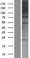 PACS1 Protein - Western validation with an anti-DDK antibody * L: Control HEK293 lysate R: Over-expression lysate