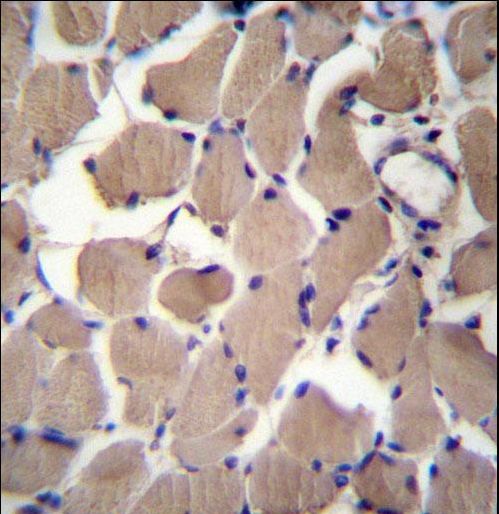PACS2 Antibody - PACS2 Antibody immunohistochemistry of formalin-fixed and paraffin-embedded human skeletal muscle followed by peroxidase-conjugated secondary antibody and DAB staining.