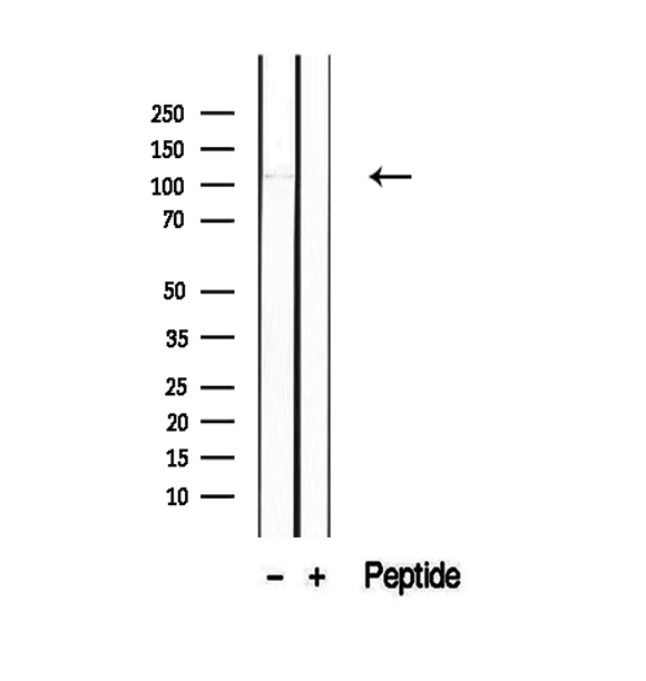 PACS2 Antibody - Western blot analysis of extracts of human brain tissue using PACS2-Specific antibody.