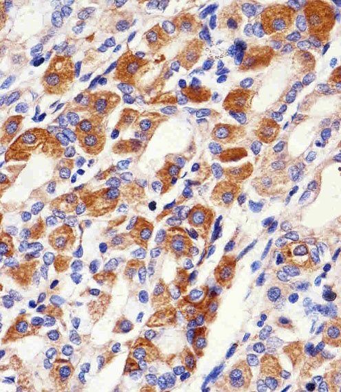 PACSIN2 Antibody - Immunohistochemical of paraffin-embedded H.stomach section using PACSIN2 Antibody. Antibody was diluted at 1:100 dilution. A peroxidase-conjugated goat anti-rabbit IgG at 1:400 dilution was used as the secondary antibody, followed by DAB staining.