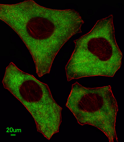 PACSIN2 Antibody - Immunofluorescence of HeLa cells, using PACSIN2 Antibody. Antibody was diluted at 1:100 dilution. Alexa Fluor 488-conjugated goat anti-rabbit lgG at 1:400 dilution was used as the secondary antibody (green). Cytoplasmic actin was counterstained with Dylight Fluor 554 (red) conjugated Phalloidin (red).