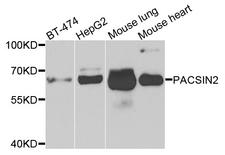 PACSIN2 Antibody - Western blot analysis of extracts of various cells.