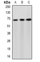 PACSIN2 Antibody - Western blot analysis of Syndapin-2 expression in HepG2 (A); mouse lung (B); mouse heart (C) whole cell lysates.