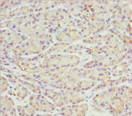 PACSIN2 Antibody - Immunohistochemistry of paraffin-embedded human pancreatic tissue at dilution 1:100