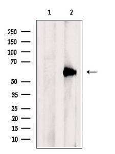 PACSIN2 Antibody - Western blot analysis of extracts of mouse lung using PACSIN2 antibody. The lane on the left was treated with blocking peptide.