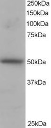 PACSIN3 Antibody - Antibody staining (1 ug/ml) of H460 lysate (RIPA buffer, 35 ug total protein per lane). Primary incubated for 1 hour. Detected by Western blot of chemiluminescence.