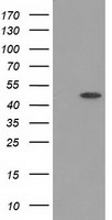 PACSIN3 Antibody - HEK293T cells were transfected with the pCMV6-ENTRY control (Left lane) or pCMV6-ENTRY PACSIN3 (Right lane) cDNA for 48 hrs and lysed. Equivalent amounts of cell lysates (5 ug per lane) were separated by SDS-PAGE and immunoblotted with anti-PACSIN3.