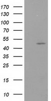 PACSIN3 Antibody - HEK293T cells were transfected with the pCMV6-ENTRY control (Left lane) or pCMV6-ENTRY PACSIN3 (Right lane) cDNA for 48 hrs and lysed. Equivalent amounts of cell lysates (5 ug per lane) were separated by SDS-PAGE and immunoblotted with anti-PACSIN3.