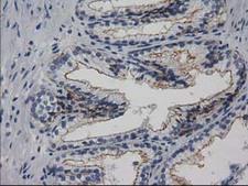 PACSIN3 Antibody - IHC of paraffin-embedded Human prostate tissue using anti-PACSIN3 mouse monoclonal antibody.
