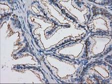 PACSIN3 Antibody - IHC of paraffin-embedded Human prostate tissue using anti-PACSIN3 mouse monoclonal antibody.