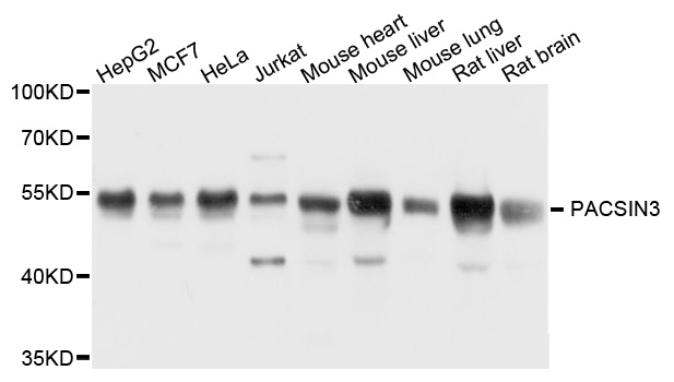PACSIN3 Antibody - Western blot analysis of extract of various cells.
