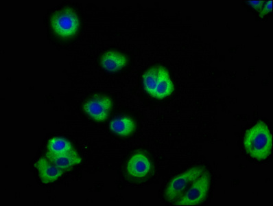 PACSIN3 Antibody - Immunofluorescence staining of HepG2 cells with PACSIN3 Antibody at 1:133, counter-stained with DAPI. The cells were fixed in 4% formaldehyde, permeabilized using 0.2% Triton X-100 and blocked in 10% normal Goat Serum. The cells were then incubated with the antibody overnight at 4°C. The secondary antibody was Alexa Fluor 488-congugated AffiniPure Goat Anti-Rabbit IgG(H+L).