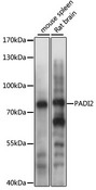 PAD2 / PADI2 Antibody - Western blot analysis of extracts of various cell lines, using PADI2 antibody at 1:1000 dilution. The secondary antibody used was an HRP Goat Anti-Rabbit IgG (H+L) at 1:10000 dilution. Lysates were loaded 25ug per lane and 3% nonfat dry milk in TBST was used for blocking. An ECL Kit was used for detection and the exposure time was 3s.