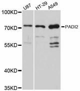 PAD2 / PADI2 Antibody - Western blot analysis of extracts of various cell lines, using PADI2 antibody at 1:3000 dilution. The secondary antibody used was an HRP Goat Anti-Rabbit IgG (H+L) at 1:10000 dilution. Lysates were loaded 25ug per lane and 3% nonfat dry milk in TBST was used for blocking. An ECL Kit was used for detection and the exposure time was 10s.