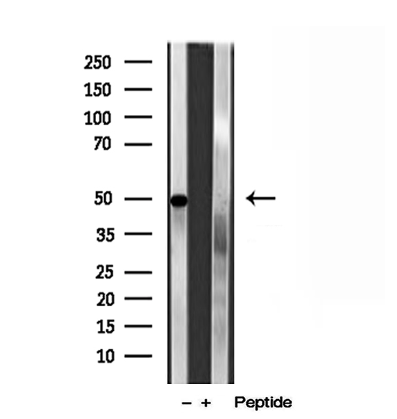 PAD2 / PADI2 Antibody - Western blot analysis of extracts of BxPC-3 cells using PADI2 antibody.