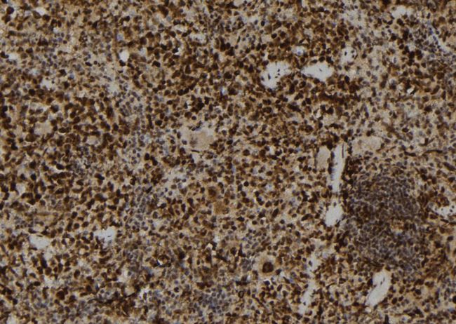 PAD2 / PADI2 Antibody - 1:100 staining mouse spleen tissue by IHC-P. The sample was formaldehyde fixed and a heat mediated antigen retrieval step in citrate buffer was performed. The sample was then blocked and incubated with the antibody for 1.5 hours at 22°C. An HRP conjugated goat anti-rabbit antibody was used as the secondary.
