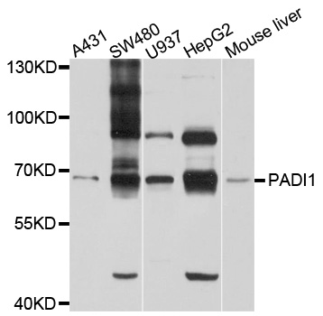 PADI1 Antibody - Western blot analysis of extracts of various cell lines, using PADI1 antibody at 1:1000 dilution. The secondary antibody used was an HRP Goat Anti-Rabbit IgG (H+L) at 1:10000 dilution. Lysates were loaded 25ug per lane and 3% nonfat dry milk in TBST was used for blocking. An ECL Kit was used for detection and the exposure time was 60s.