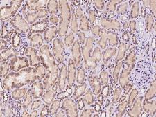 PADI3 Antibody - Immunochemical staining of human PADI3 in human kidney with rabbit polyclonal antibody at 1:100 dilution, formalin-fixed paraffin embedded sections.