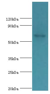 PADI4 / PAD4 Antibody - Western blot. All lanes: Protein-arginine deiminase type-4 antibody at 3 ug/ml+mouse skeletal muscle. Secondary antibody: Goat polyclonal to rabbit at 1:10000 dilution. Predicted band size: 74 kDa. Observed band size: 74 kDa.