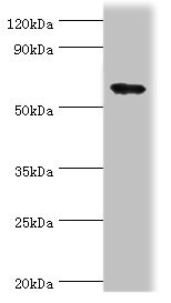 PADI4 / PAD4 Antibody - Western blot All lanes: Protein-arginine deiminase type-4 antibody at 3µg/ml + Mouse skeletal muscleSecondary Goat polyclonal to rabbit IgG at 1/10000 dilution Predicted band size: 74 kDa Observed band size: 74 kDa