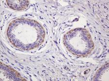 PADI4 / PAD4 Antibody - IHC of paraffin-embedded Human breast tissue using anti-PADI4 mouse monoclonal antibody.