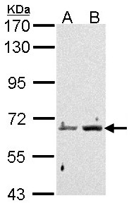 PADI4 / PAD4 Antibody - Sample (30 ug of whole cell lysate). A: Hela, B: Hep G2 . 7.5% SDS PAGE. PADI4 / PAD4 antibody diluted at 1:1000.