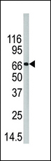 PADI4 / PAD4 Antibody - Western blot of anti-PAD4 antibody in 293 cell line lysate. PAD4(arrow) was detected using the purified antibody.