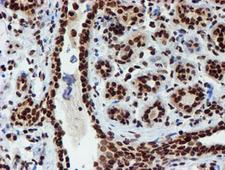 PADI4 / PAD4 Antibody - IHC of paraffin-embedded Human breast tissue using anti-PADI4 mouse monoclonal antibody.