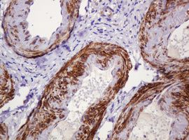 PADI4 / PAD4 Antibody - IHC of paraffin-embedded Human Ovary tissue using anti-PADI4 mouse monoclonal antibody.