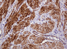 PADI4 / PAD4 Antibody - IHC of paraffin-embedded Human endometrium tissue using anti-PADI4 mouse monoclonal antibody.