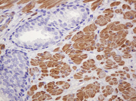 PADI4 / PAD4 Antibody - IHC of paraffin-embedded Human prostate tissue using anti-PADI4 mouse monoclonal antibody.