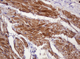PADI4 / PAD4 Antibody - IHC of paraffin-embedded Human bladder tissue using anti-PADI4 mouse monoclonal antibody.