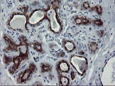 PADI4 / PAD4 Antibody - IHC of paraffin-embedded Human breast tissue using anti-PADI4 mouse monoclonal antibody.