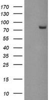 PADI4 / PAD4 Antibody - HEK293T cells were transfected with the pCMV6-ENTRY control (Left lane) or pCMV6-ENTRY PADI4 (Right lane) cDNA for 48 hrs and lysed. Equivalent amounts of cell lysates (5 ug per lane) were separated by SDS-PAGE and immunoblotted with anti-PADI4.