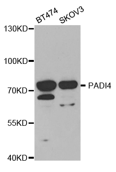 PADI4 / PAD4 Antibody - Western blot analysis of extracts of various cell lines.