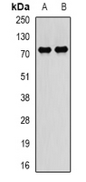 PADI4 / PAD4 Antibody - Western blot analysis of PADI4 expression in BT474 (A); SKOV3 (B) whole cell lysates.