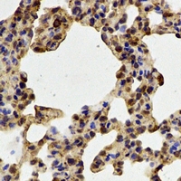 PADI4 / PAD4 Antibody - Immunohistochemical analysis of PADI4 staining in rat lung formalin fixed paraffin embedded tissue section. The section was pre-treated using heat mediated antigen retrieval with sodium citrate buffer (pH 6.0). The section was then incubated with the antibody at room temperature and detected using an HRP conjugated compact polymer system. DAB was used as the chromogen. The section was then counterstained with hematoxylin and mounted with DPX.