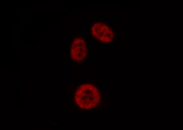PADI4 / PAD4 Antibody - Staining HepG2 cells by IF/ICC. The samples were fixed with PFA and permeabilized in 0.1% Triton X-100, then blocked in 10% serum for 45 min at 25°C. The primary antibody was diluted at 1:200 and incubated with the sample for 1 hour at 37°C. An Alexa Fluor 594 conjugated goat anti-rabbit IgG (H+L) antibody, diluted at 1/600, was used as secondary antibody.