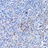 PADI4 / PAD4 Antibody - Immunohistochemistry of paraffin-embedded Human tonsil using PADI4 Polyclonal Antibody at dilution of 1:100 (40x lens).