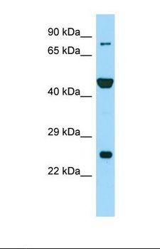 PADI6 Antibody - Western blot of Human RPMI-8226. PADI6 antibody dilution 1.0 ug/ml.  This image was taken for the unconjugated form of this product. Other forms have not been tested.