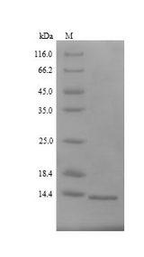 Cyclomaltodextrin glucanotransferase Protein - (Tris-Glycine gel) Discontinuous SDS-PAGE (reduced) with 5% enrichment gel and 15% separation gel.