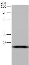 PAEP / Glycodelin / GdF Antibody - Western blot analysis of Mouse liver tissue, using PAEP Polyclonal Antibody at dilution of 1:300.