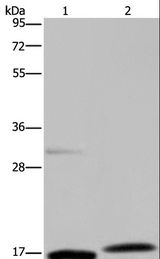 PAEP / Glycodelin / GdF Antibody - Western blot analysis of Mouse adrenal gland and liver tissue, using PAEP Polyclonal Antibody at dilution of 1:250.