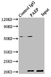 PAEP / Glycodelin / GdF Antibody - Immunoprecipitating PAEP in 293T whole cell lysate Lane 1: Rabbit control IgG instead of PAEP Antibody in 293T whole cell lysate.For western blotting, a HRP-conjugated Protein G antibody was used as the secondary antibody (1/2000) Lane 2: PAEP Antibody (8µg) + 293T whole cell lysate (500µg) Lane 3: 293T whole cell lysate (10µg)