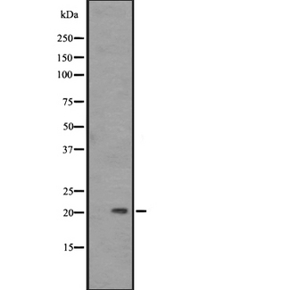 PAEP / Glycodelin / GdF Antibody - Western blot analysis of PAEP expression in A431 whole cells lysate. The lane on the left is treated with the antigen-specific peptide.