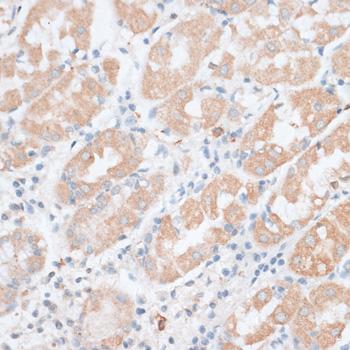 PAEP / Glycodelin / GdF Antibody - Immunohistochemistry of paraffin-embedded Human stomach using PAEP Polyclonal Antibody at dilution of 1:100 (40x lens).