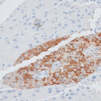 PAEP / Glycodelin / GdF Antibody - Immunohistochemistry of paraffin-embedded Mouse pancreas using PAEP Polyclonal Antibody at dilution of 1:100 (40x lens).