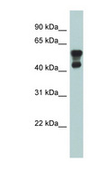 PAFAH1B1 / LIS1 Antibody - PAFAH1B1 / LIS1 antibody Western blot of Fetal Lung lysate. This image was taken for the unconjugated form of this product. Other forms have not been tested.